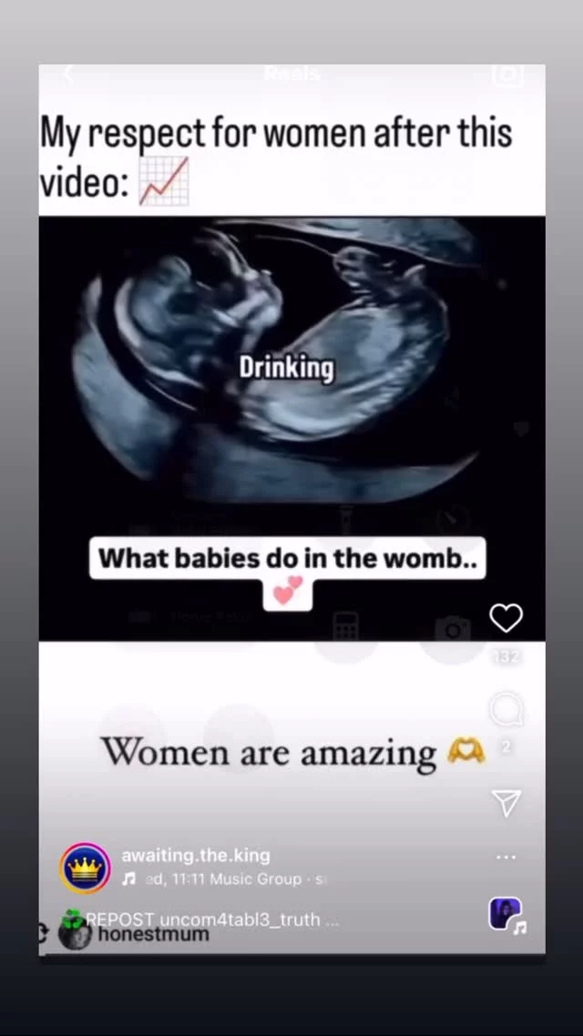 This is amazing!!!!! This just shows that these babies are a gift from God and worthy of life!!!
#prolife #parents #jesus #family #church 

@awaiting.the.king